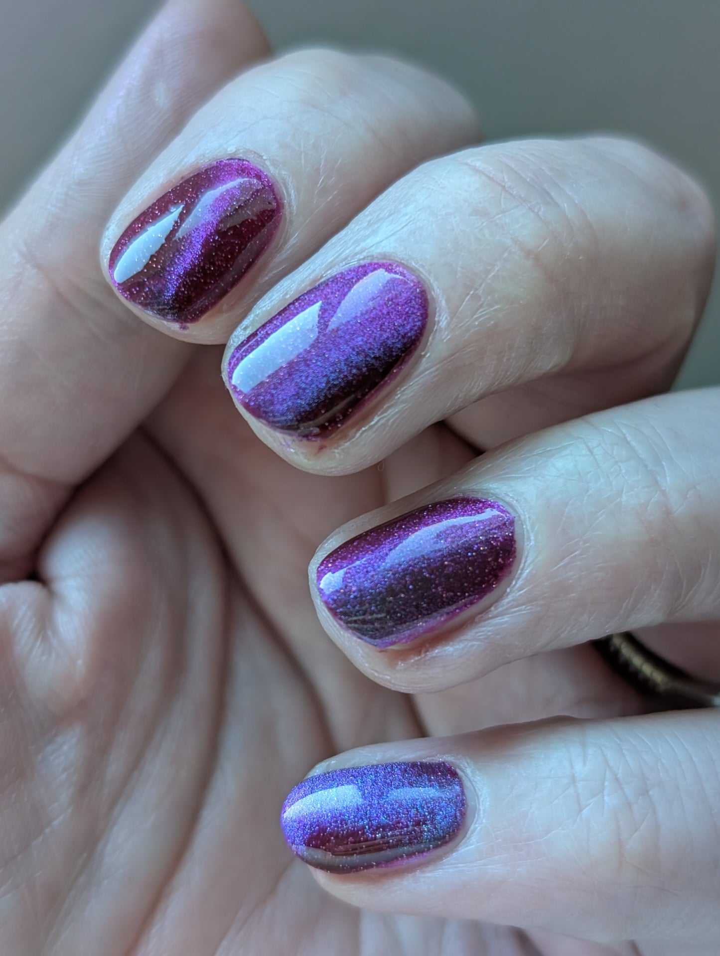 The Scars Are Part of Me (magnetic)